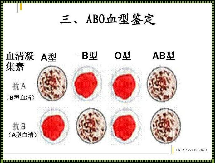 孕妇AB血型对宝宝的影响