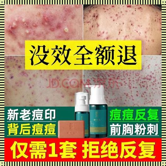 背后痘痘去除秘籍：探索自然疗法与生活调整