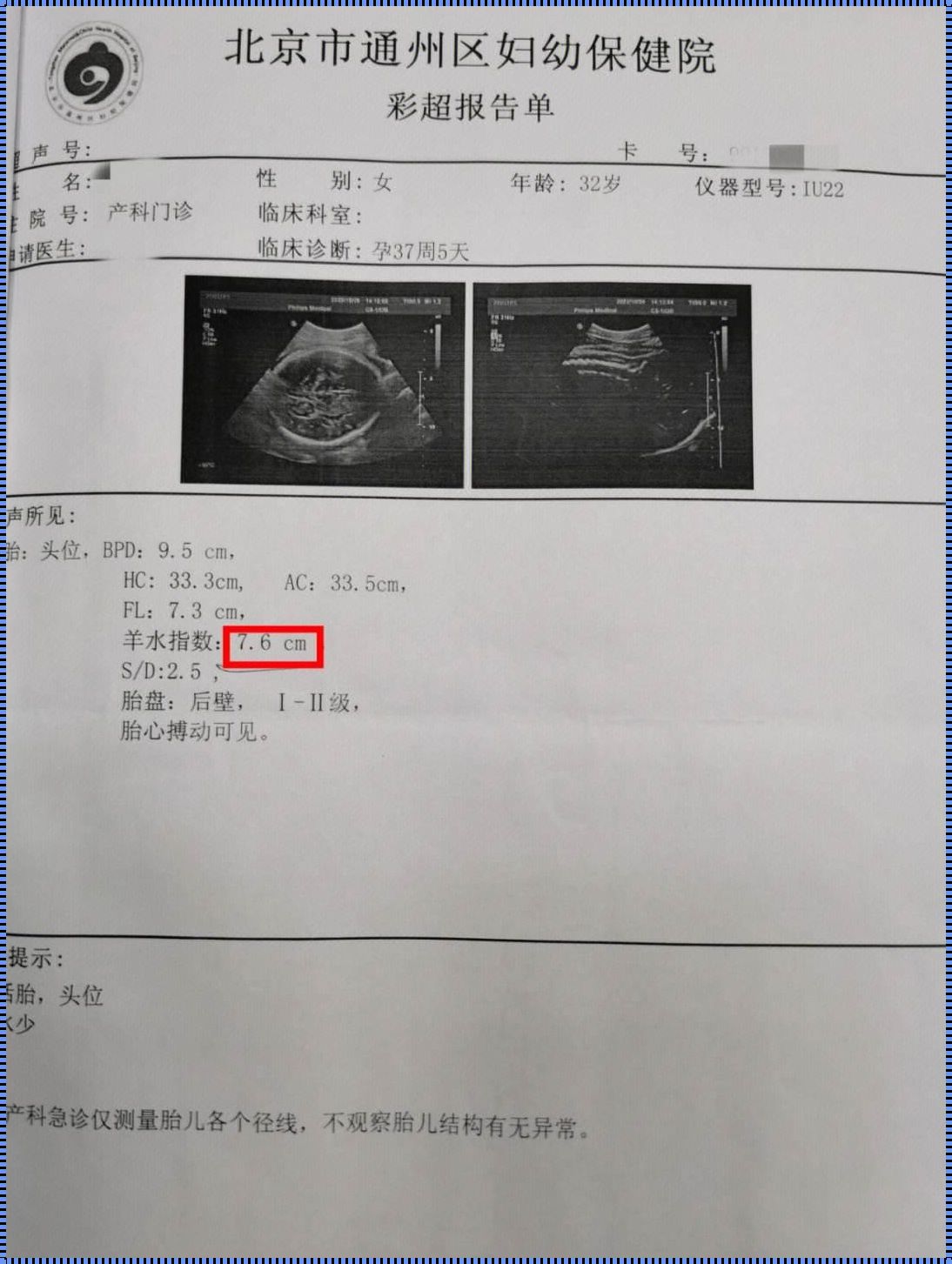 37周羊水少了怎么补